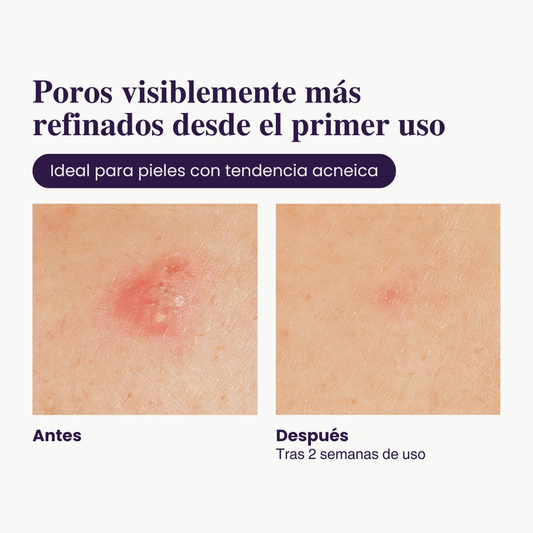 2X1 - Exfoliante de Arroz Iluminador