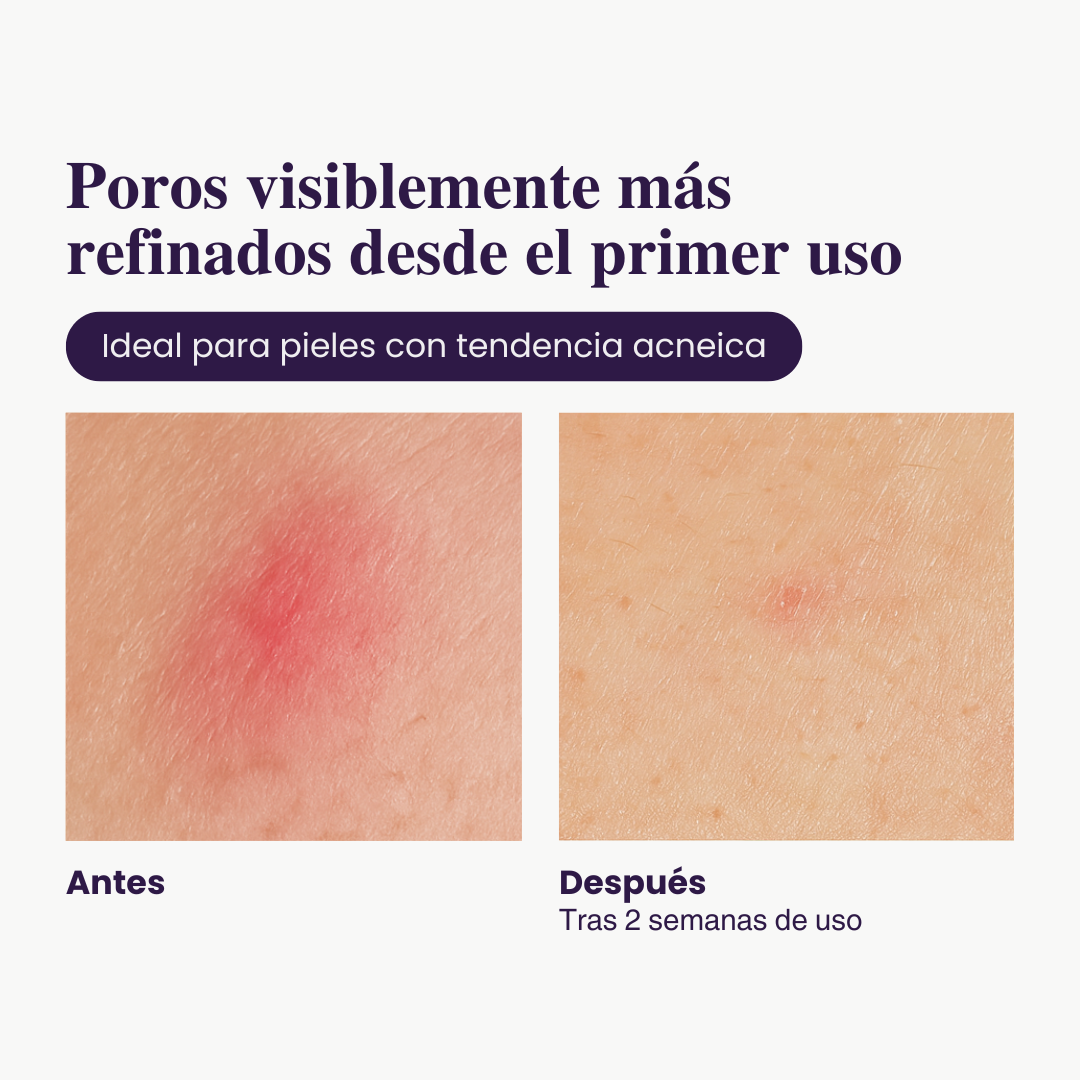 2X1 - Exfoliante de Arroz Iluminador
