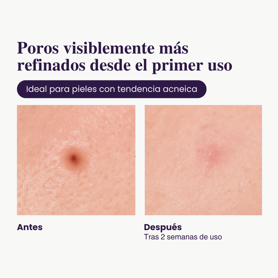 2X1 - Exfoliante de Arroz Iluminador