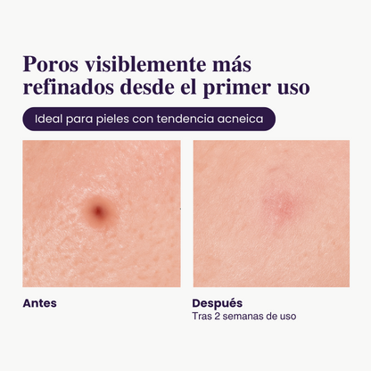 2X1 - Exfoliante de Arroz Iluminador
