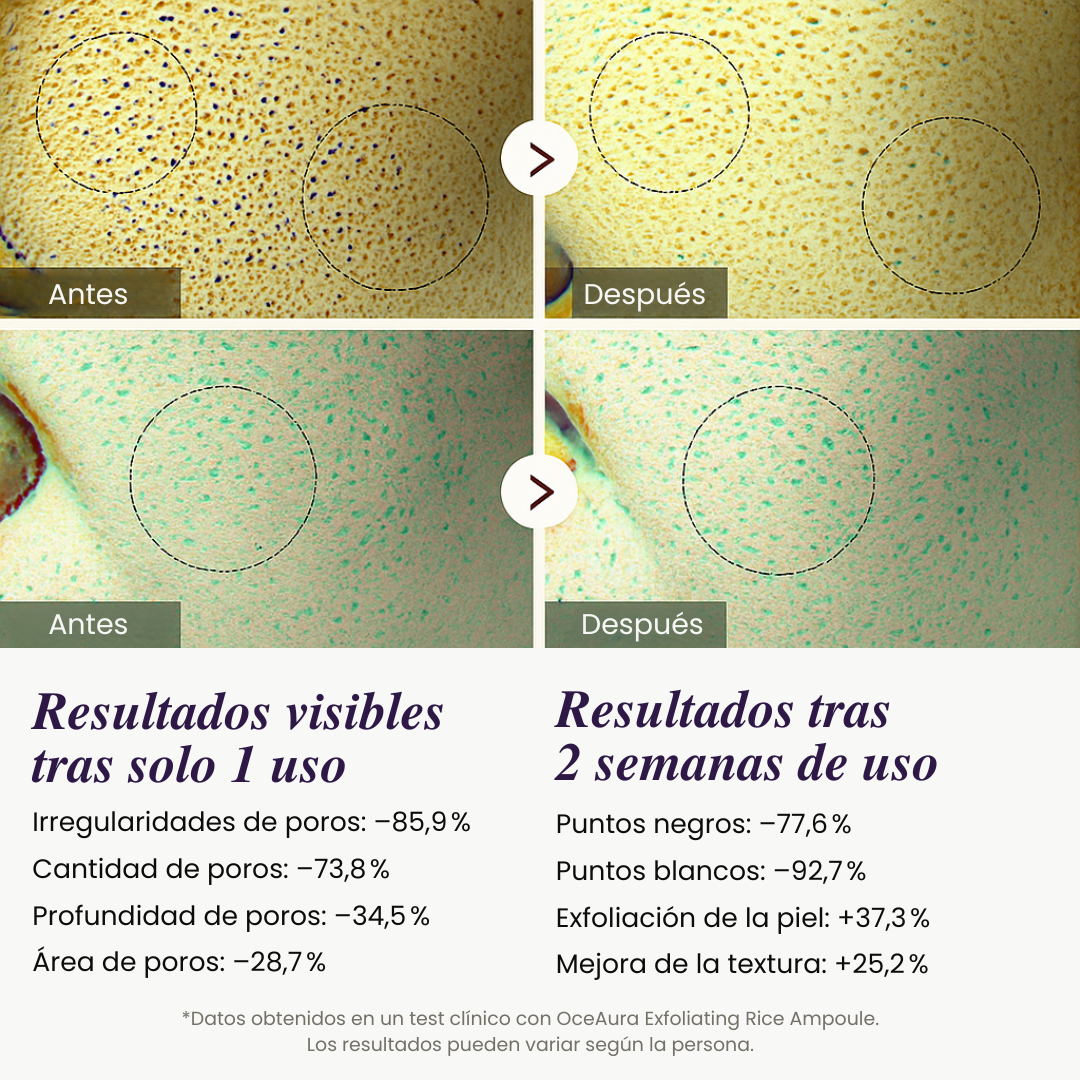 2X1 - Exfoliante de Arroz Iluminador