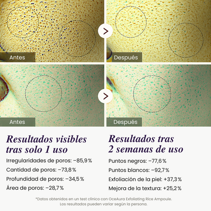 2X1 - Exfoliante de Arroz Iluminador